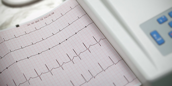 Image representing ATRIAL FIBRILLATION