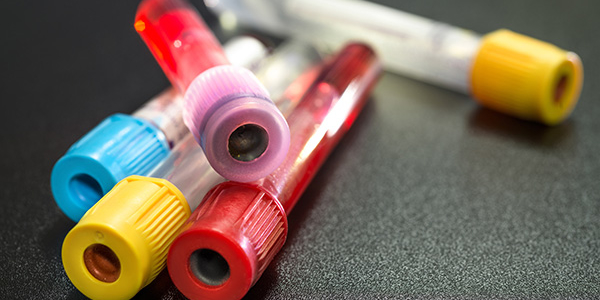 Image representing TEST RESULTS
